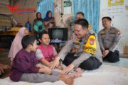 Dibiayai Jenderal Bintang 2, Adik-Kakak Penderita Tulang Kaca di Pekanbaru Berangsur Pulih