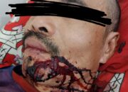 Ayahnya Dituduh Membakar Pondok Kebun Karet, Alepi Laia Harapkan Polres Nisel Proses Laporan Penganiayaan Tanonafao Laia