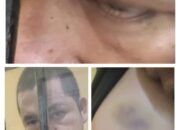 Soal Penyiksaan Seorang Tahanan di Sel Polres Pelalawan, Ketua KNPI Riau Desak Kapolda Lakukan Supervisi dan Gelar Perkara Khusus