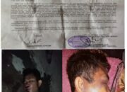Lapor Pak Kapolda Riau,!!! Beberapa Pelaku Penganiayaan/Pengeroyokan Ohi Jisekhi Bu,ulolo Belum Ditangkap dan Warung TuakNya Belum Ditutup, Ada Apa?